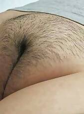 Mildly hairy